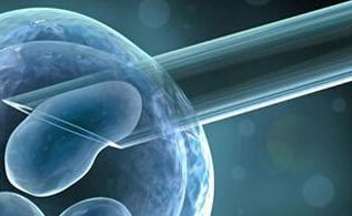 2026年想去庐山市做试管婴儿需要准备哪些事？详细收费明细一览